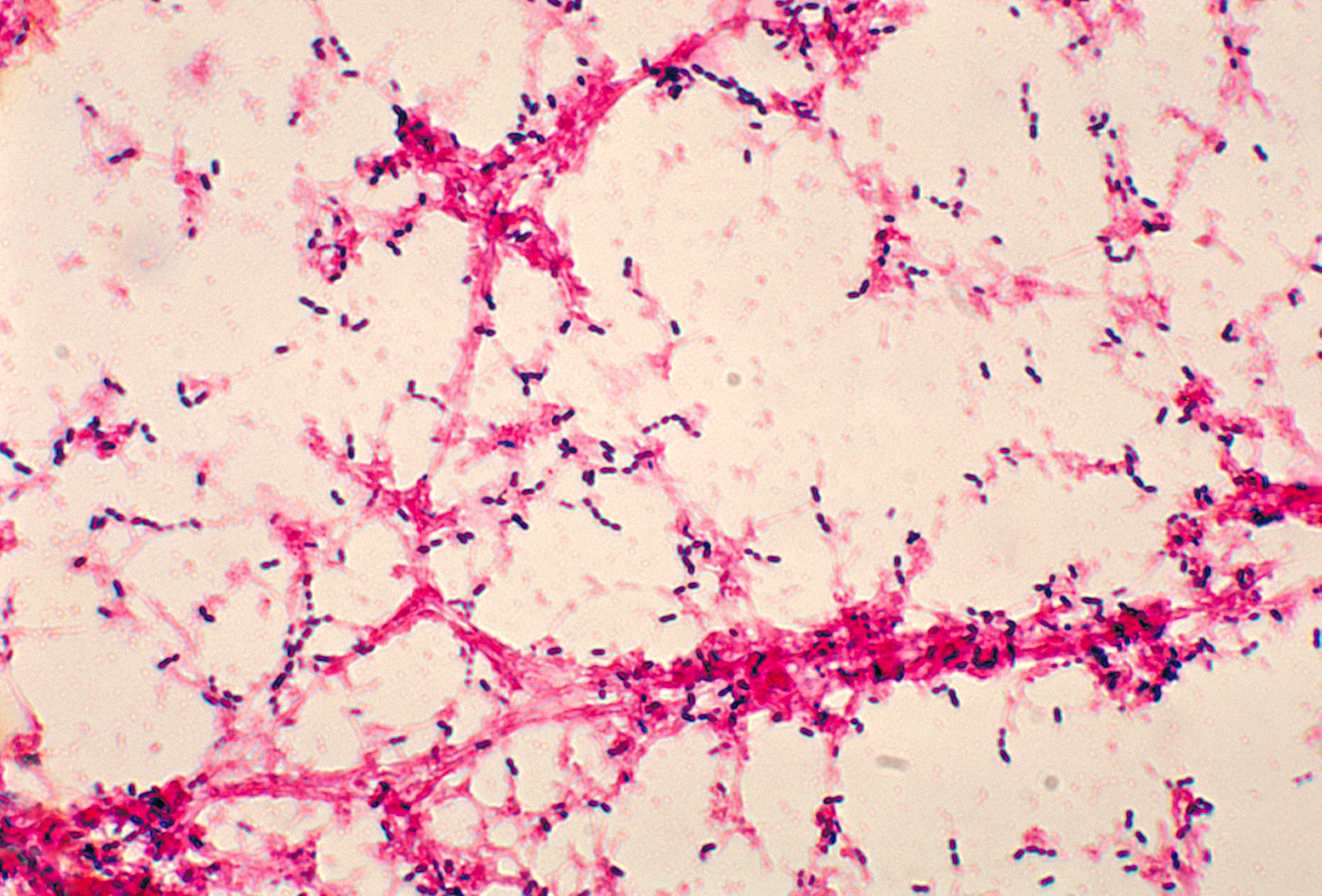 Photomicrograph of Streptococcus pneumoniae bacteria grown from a blood culture. Source: CDC Public Health Image Library