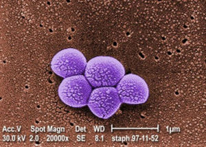 scanning electron micrograph (SEM) image of a grouping of methicillin resistant Staphylococcus aureus (MRSA) bacteria.