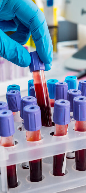 bloodtestvials
