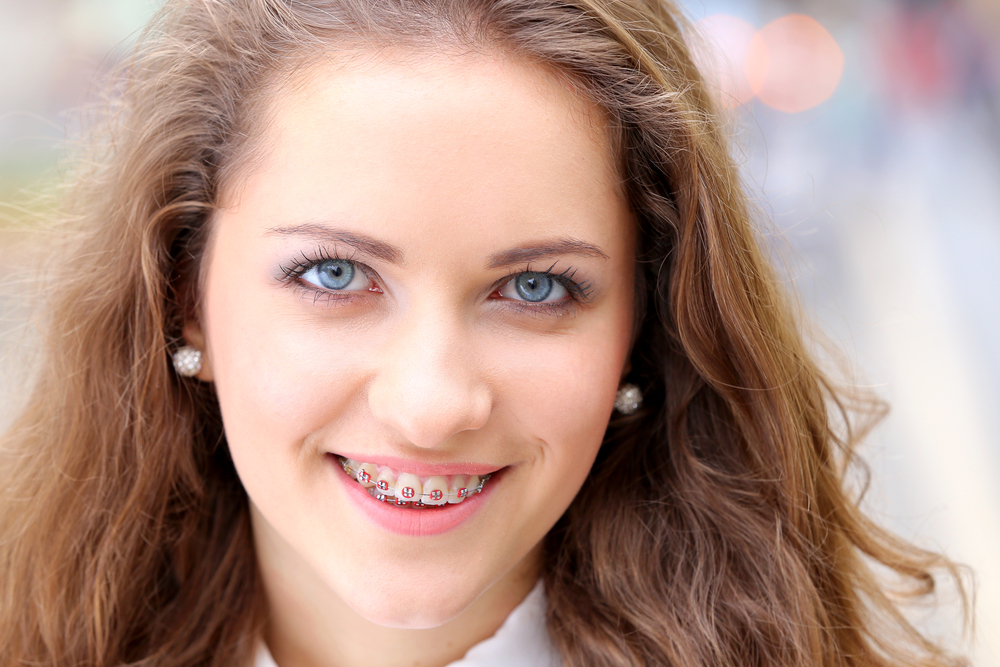 teen girl with braces