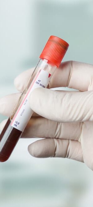 hand with blood collection tube