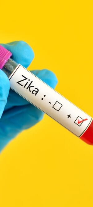 zika on test tube