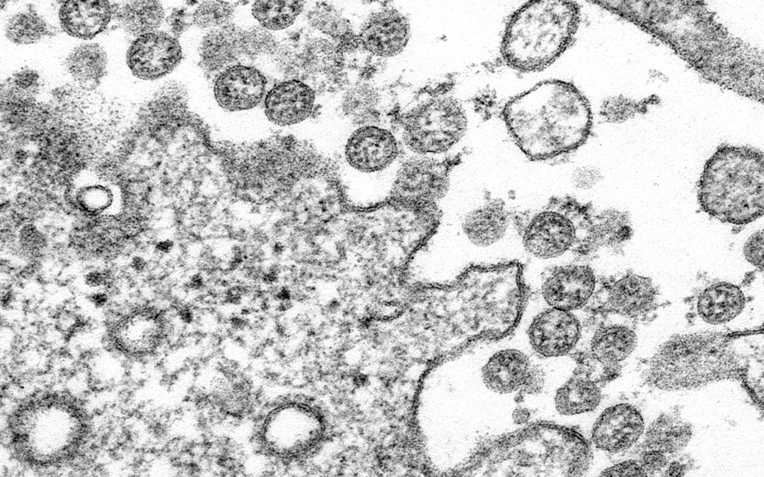 Special Testing Study Finds No New Wyoming State Hospital Coronavirus Cases