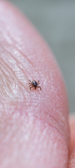 tick on finger close up