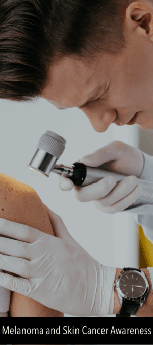 Skin Cancer LinkedIn Graphic 4