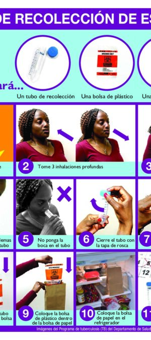 Sputum Collection (SPANISH)
